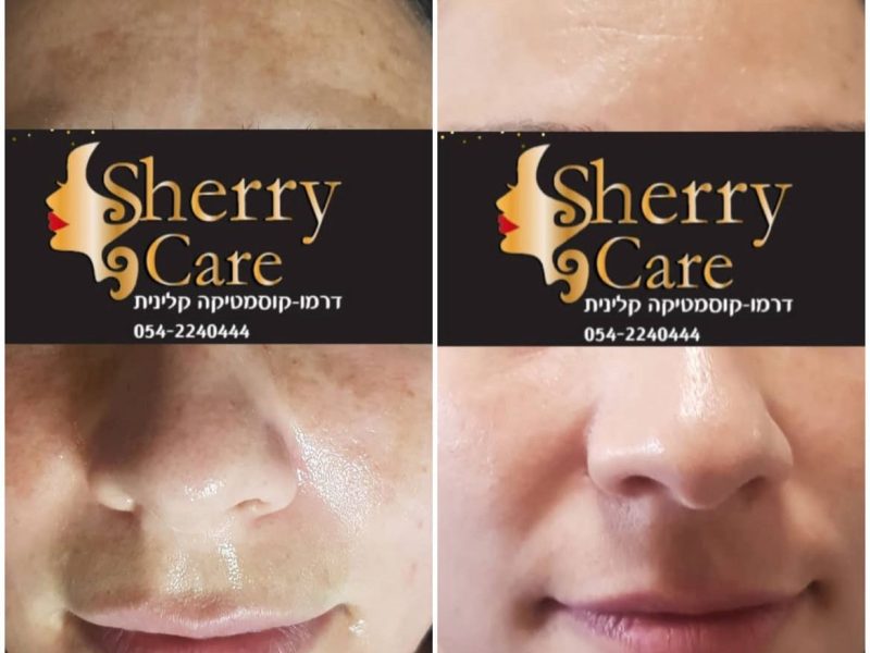 WhatsApp Image 2025-07-14 at 01.04.46