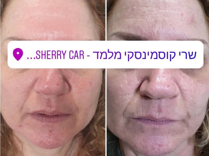 WhatsApp Image 2025-07-14 at 01.04.47 (1)