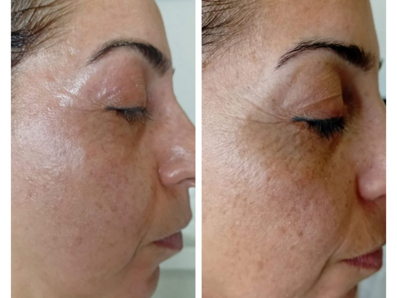 WhatsApp Image 2025-08-13 at 16.59.12